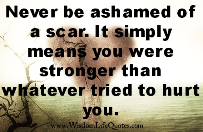 Never be ashamed of a scar